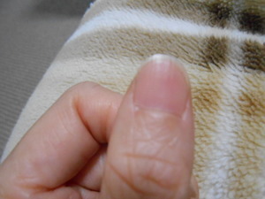 爪が割れる 二枚爪が治った 原因と対処法決定版 浪費が止まるブログ